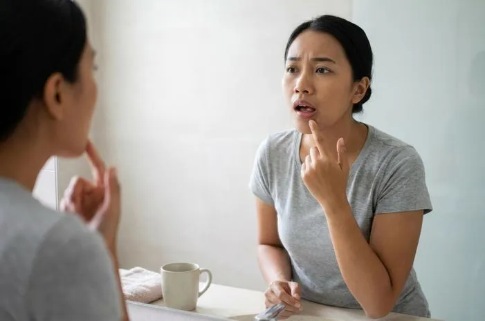 Bawah Lidah Sakit? Jangan Panik, Ini Solusinya!