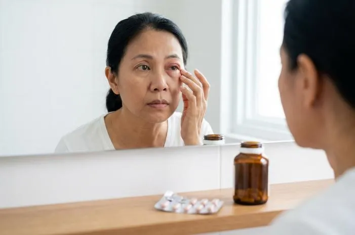 Alergi Obat Mata Bengkak: Kenali dan Atasi Segera