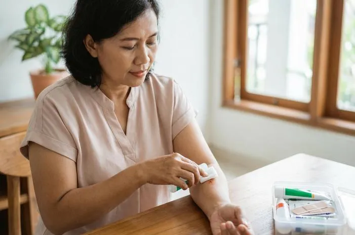 8 Cara Efektif Agar Luka Berair Cepat Kering dan Sembuh