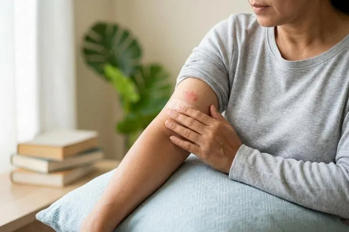 Shingles: Kenali Cacar Ular dan Cara Cepat Atasinya