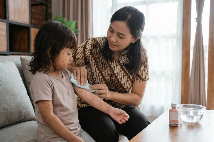 Tips Ampuh Cara Menghilangkan Gatal Campak pada Anak