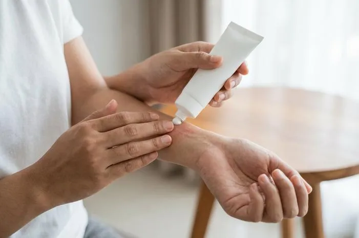 Salep Betamethasone untuk Apa? Atasi Gatal dan Radang Kulit