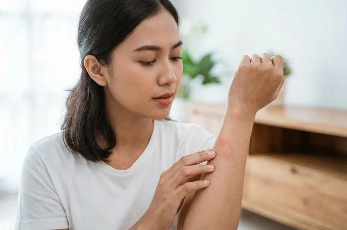 Bercak Merah Kulit: Kapan Kamu Harus Waspada?