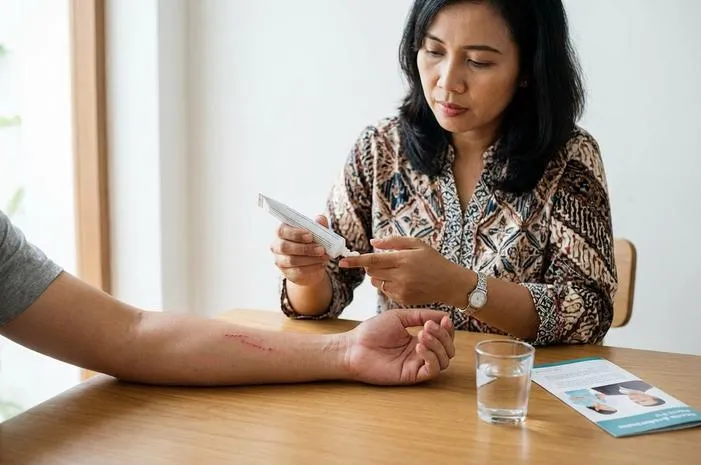 Gigitan Tomcat Seperti Apa: Panas Perih Mirip Luka Bakar