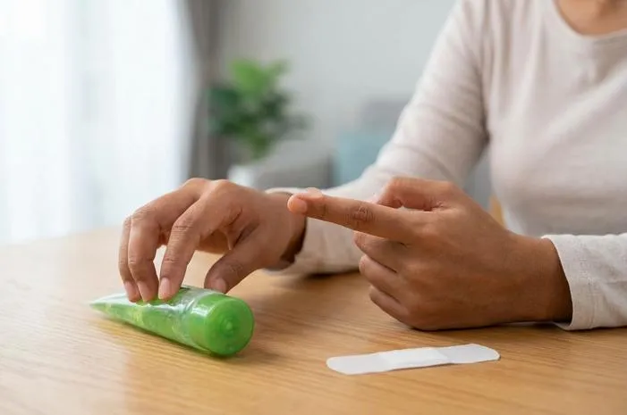 Luka Bakar Melepuh: Jangan Dipecahkan! Cegah Infeksi