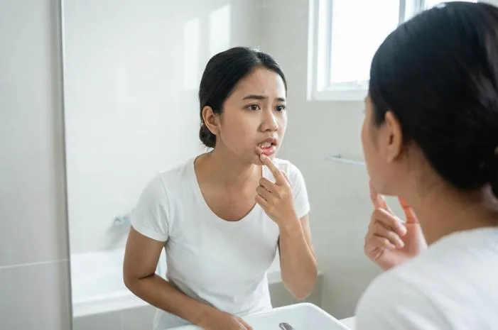 Penyebab Gusi Ada Benjolan Putih: Sariawan hingga Serius