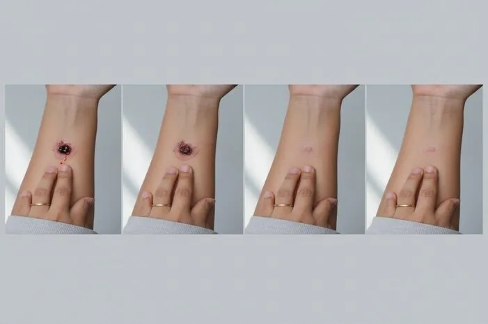 Panduan 4 Fase Penyembuhan Luka Anti Gagal