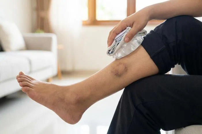 Luka Lebam di Kaki: Kenali Sebabnya dan Obati Mudah