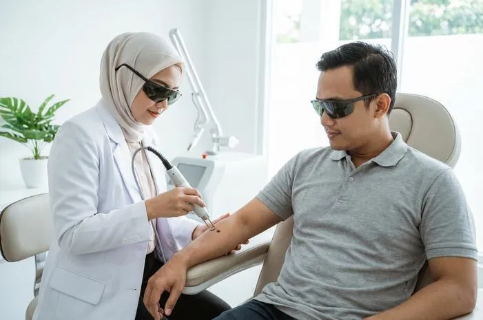 Laser Tahi Lalat: Cepat, Minim Nyeri, Minim Bekas Luka