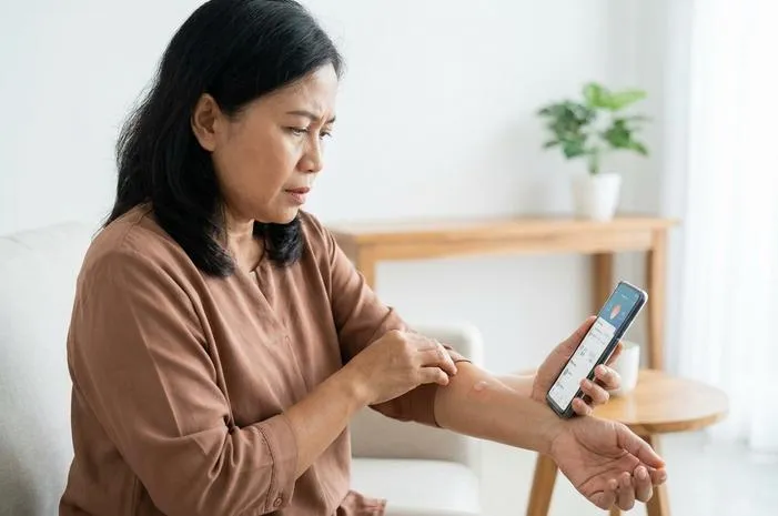 Kenali Penyebab Kulit Melepuh Tiba Tiba, Bahaya Gak Sih?