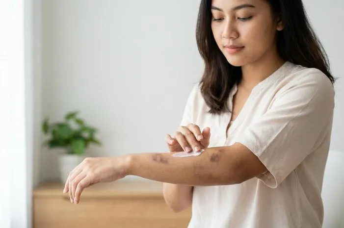 Bekas Gatal Menghitam? Cerahkan Lagi dengan Cara Ini!