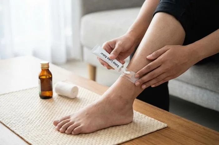 Obat Kaki Kena Knalpot: Jangan Panik, Lakukan Ini!