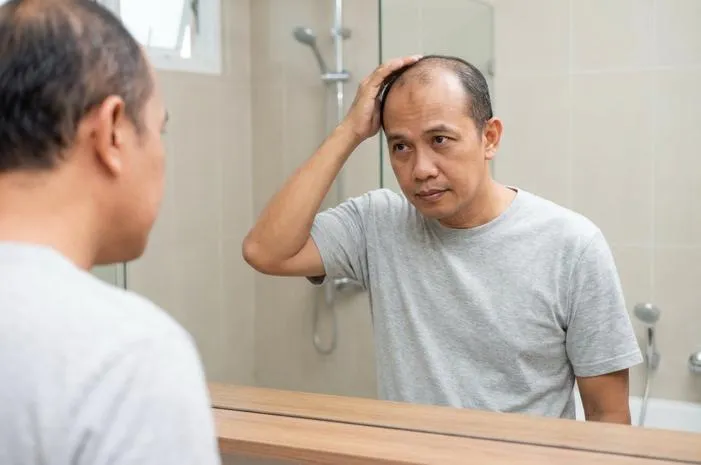 Kebotakan Itu Biasa, Kok! Yuk Pahami dan Temukan Solusi