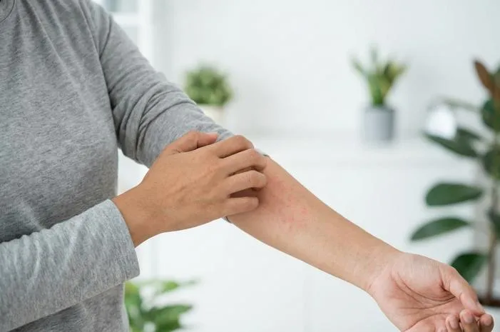 Gatal Gatal Alergi: Pahami Penyebab dan Cara Atasi