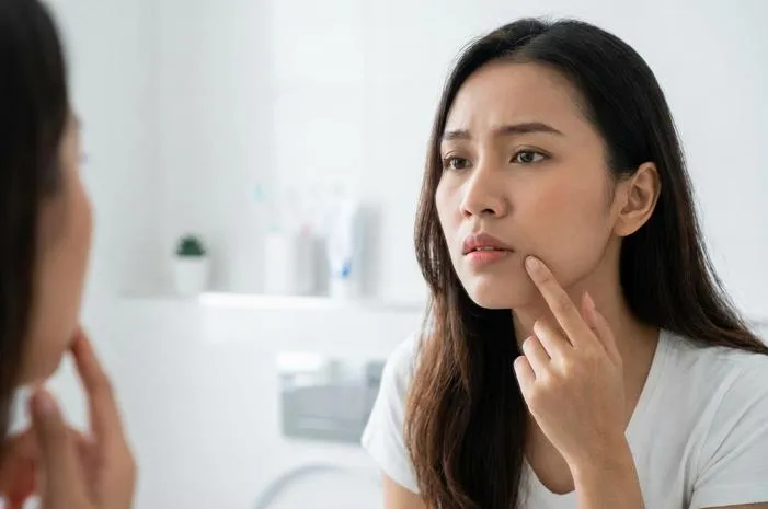 Bisul di Gusi: Jerawat di Mulut, Atasi Yuk!