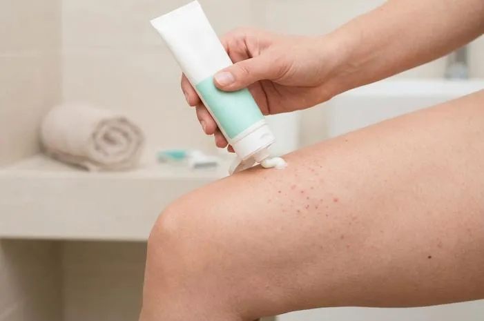 Bentol Usai Cukur Bulu Kemaluan? Redakan Gatalnya!