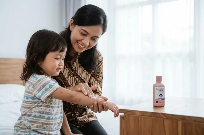 Tips Pengobatan Cacar Air Pada Anak Agar Cepat Sembuh