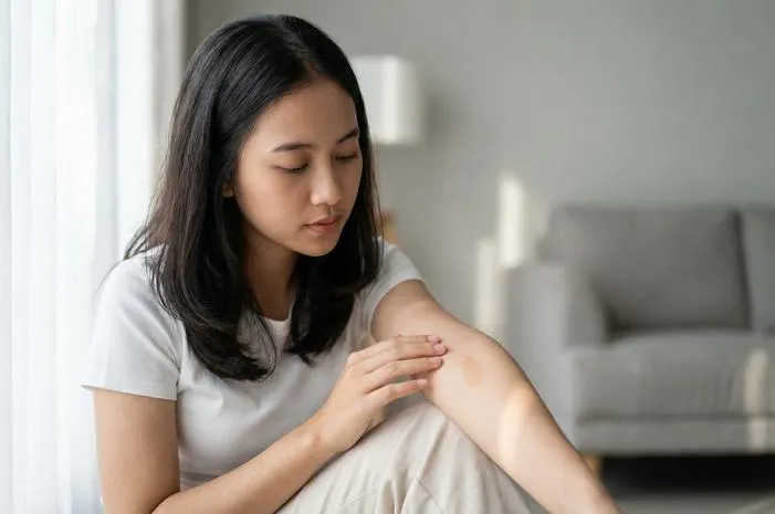 Apakah Tanda Lahir Bisa Hilang? Ini Jawaban Lengkapnya!