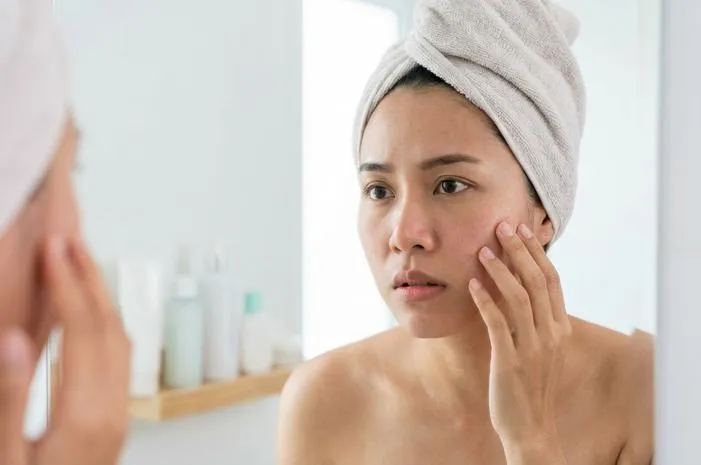 Efek Samping Retinol: Kulit Kering, Perih? Ini Solusinya!