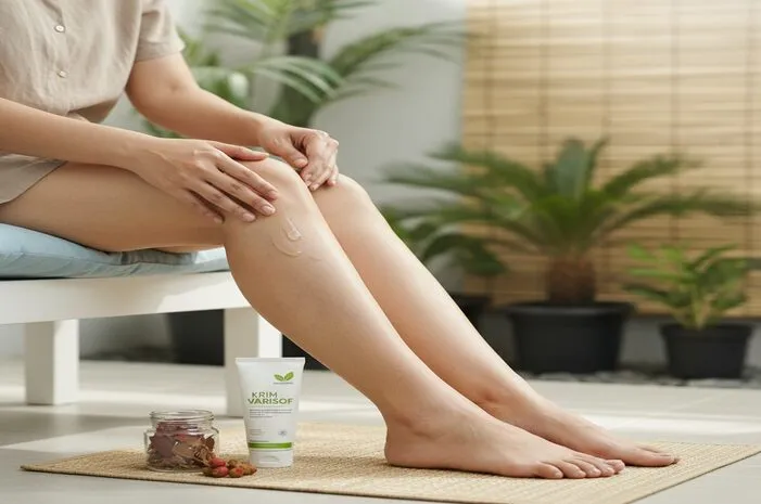 Obat Varises Paling Ampuh? Tanya Dokter Yuk!