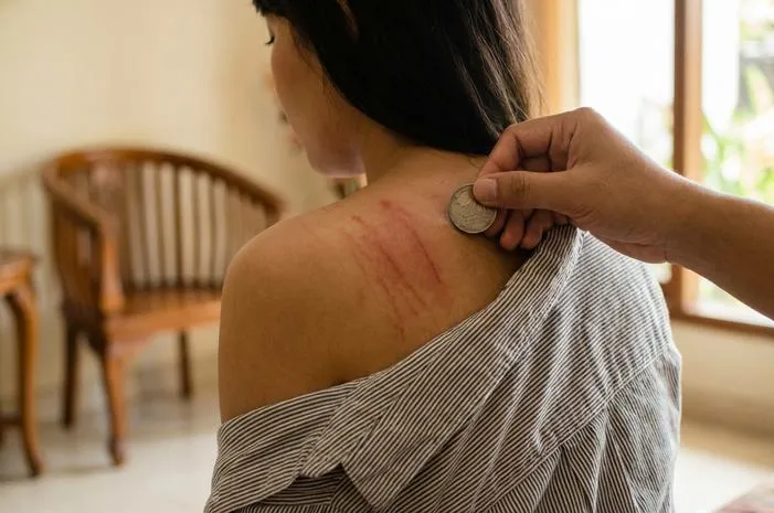 Dikerok: Solusi Masuk Angin atau Perlu Diwaspadai?