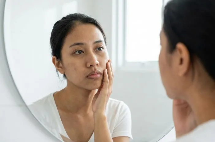 Ciri Ciri Muka Kusam: Wajah Tak Bercahaya Itu Kamu?