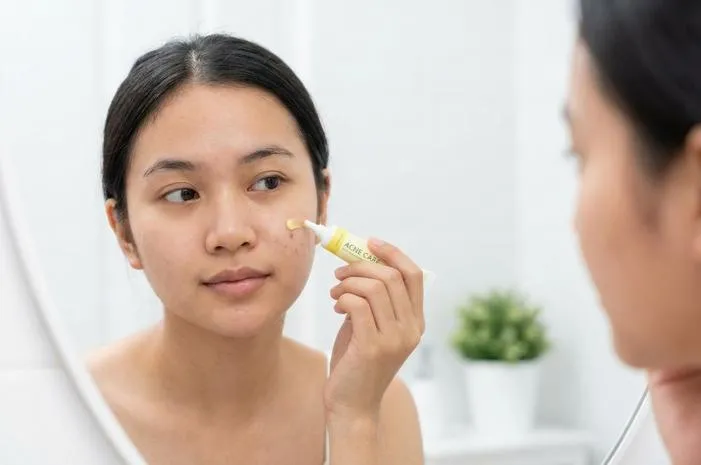JF Sulfur Acne Care: Kulit Bersih, Jerawat Kabur!
