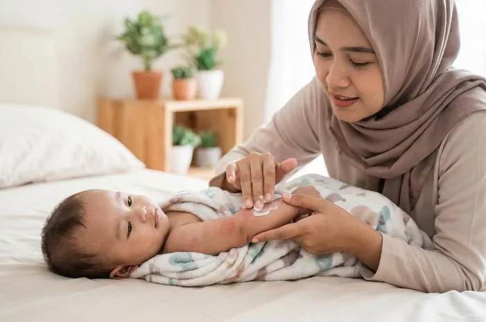 Eksim Bayi Gatal? Atasi dengan Tips Ampuh Ini