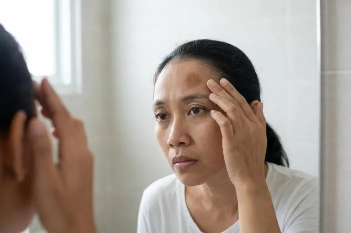 Tanda Hitam di Jidat: Mitos atau Fakta Kesalehan?