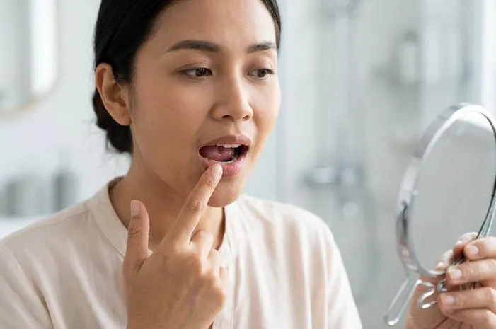 Benjolan Kecil di Bawah Lidah: Penyebab dan Kapan ke Dokter