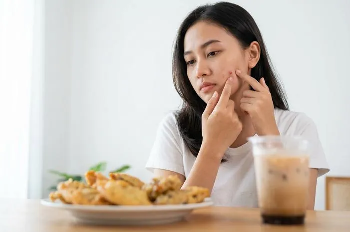 Bikin Jerawatan? Kenali Makanan Penyebab Jerawat di Pipi