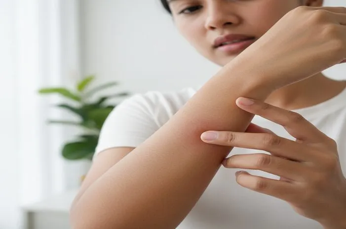 Luka Gatal Melingkar Bikin Risih? Ini Cara Mengatasinya