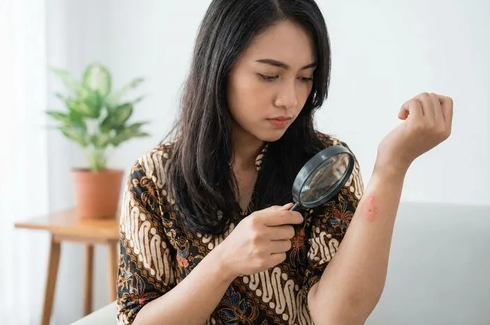 Bahaya Gigitan Tomcat Menular: Bukan Infeksi Lho!