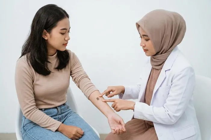 Tanda Lahir Hitam: Wajar atau Harus Waspada?