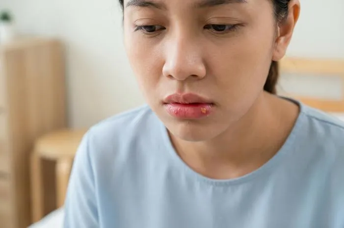 Bibir Bengkak Bernanah? Atasi Cepat dan Tepat!
