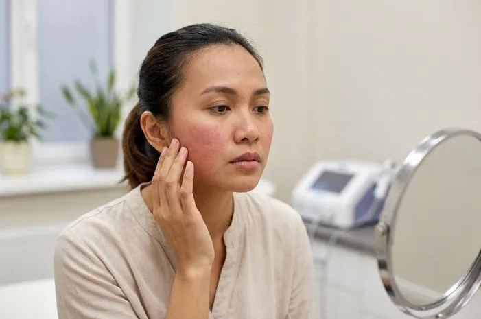 Kenali Efek Samping HIFU Wajah Sebelum Treatment