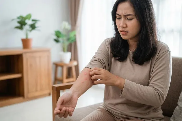 Badan Gatal Bentol Merah? Ini Cara Atasi dengan Cepat