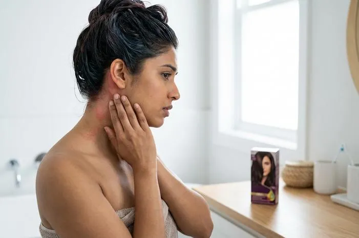 Alergi Cat Rambut Bikin Gatal? Atasi Sekarang!