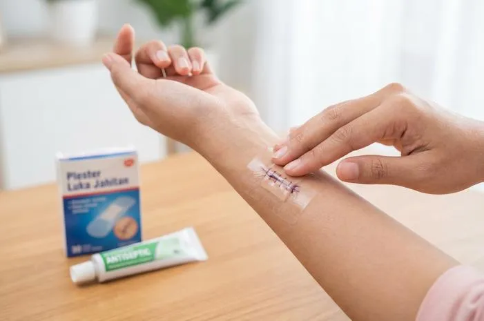Rahasia Plester Luka Jahitan Cepat Kering dan Sembuh