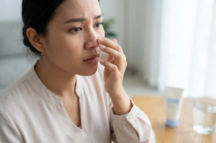 Kenapa Kulit Hidung Mengelupas? Jangan Panik, Ini Solusinya