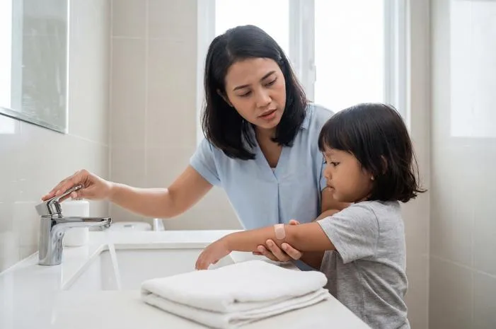 Luka Bakar Boleh Kena Air, Tapi Perhatikan Hal Ini