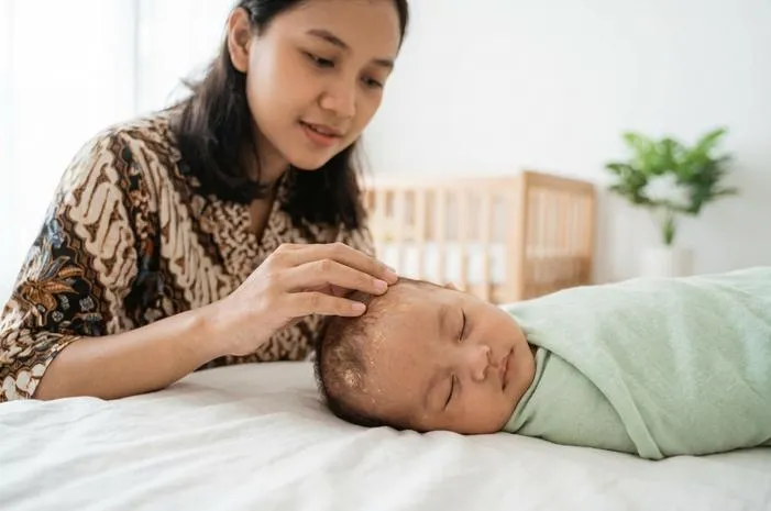 Dermatitis Seboroik Bayi: Tenang, Kerak Kepala Mudah Hilang