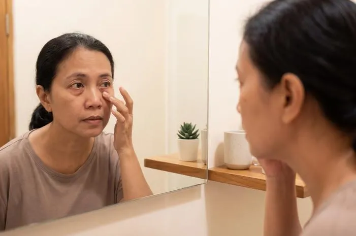 Penyebab Bintitan di Bawah Mata: Kenali Pemicunya!