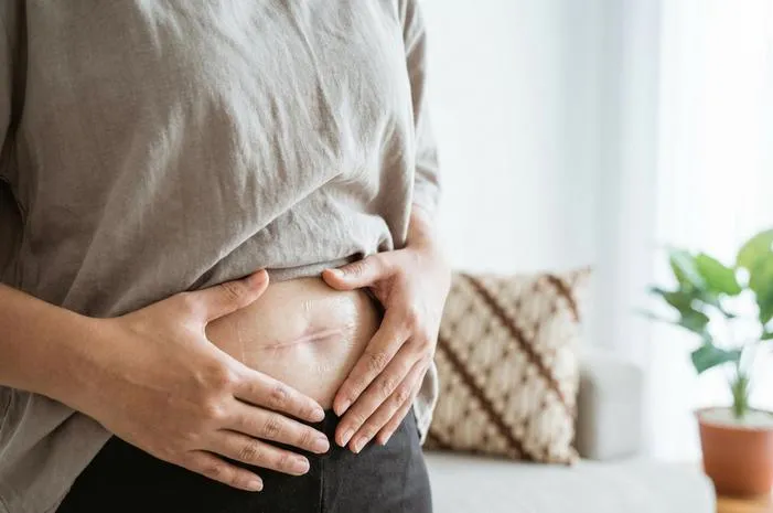 Luka Bekas Caesar Cantik: Tips Rawat Optimal
