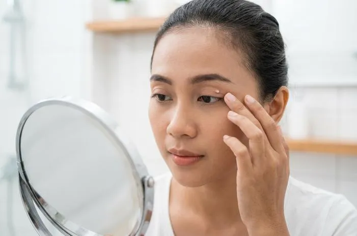 Di Kelopak Mata Ada Bintik Putih? Ini Sebab dan Solusi