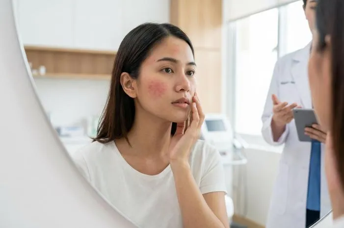 Efek Samping Pico Laser: Wajar dan Mudah Diatasi Kok!