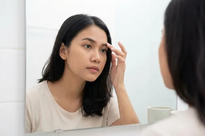 Ketombe di Alis Bikin Gatal? Ini Tips Mulus Bebas Sisik!