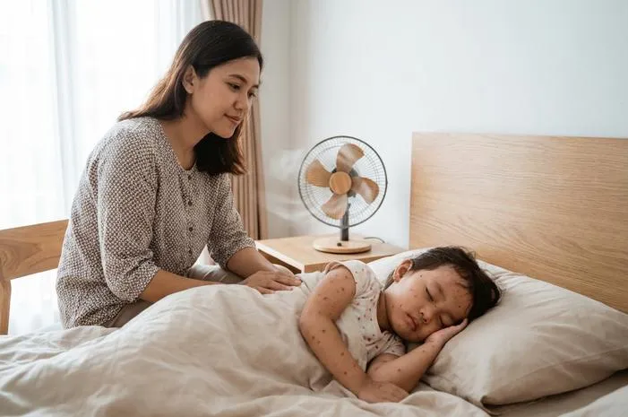 Cacar Air Boleh Kena Kipas Angin Asal Tahu Caranya