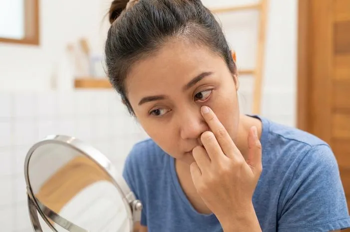 Bintik Putih di Dalam Kelopak Mata? Tenang, Ini Solusinya!