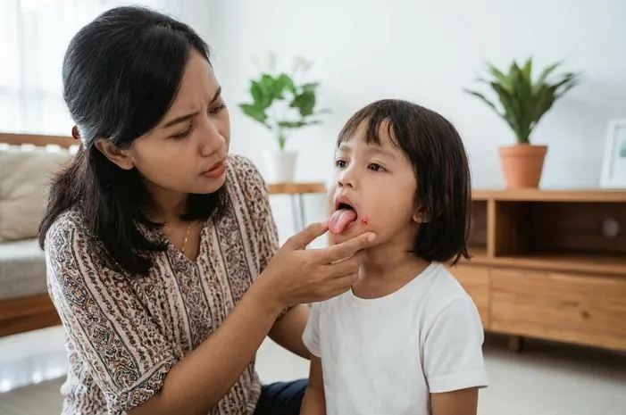 Lidah Sariawan pada Anak: Atasi Nyeri Si Kecil!